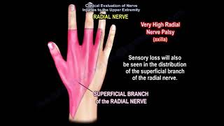 radial nerve injury wrist drop anatomy of the radial nerve [upl. by Yelnats95]