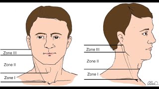 Zones of The Neck  Zone 1 Zone 2 and Zone 3 [upl. by Abraham]