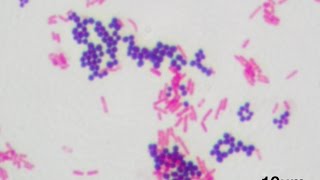 How to Do a Gram Stain [upl. by Eibmab717]