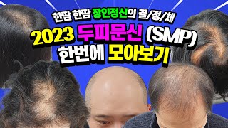 모음7탈모인 모여라 가르마탈모 정수리탈모 민머리 전부 커버 SSAP가능 자연스러운 두피문신smp [upl. by Foster]