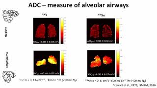 ISMRM MR Academy  Methods and Applications of Hyperpolarized 129Xe [upl. by Finlay]