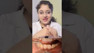 Dental Teeth Cleaning Dentist Cleaning Teeth Why Dental Cleaning Treatment is Important [upl. by Leivad224]