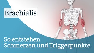 Brachialis Schmerzen Triggerpunkte und deren Aktivierung [upl. by Julide]