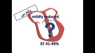 ESC Guidelines Managing HFpEF Arabic Version [upl. by Cody978]