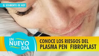 Conoce los riesgos del Plasma Pen Fribroplast [upl. by Abbi]