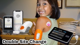 Dexcom G6 amp Tandem Tslim x2 Insertion  Type One Diabetes [upl. by Ardna]