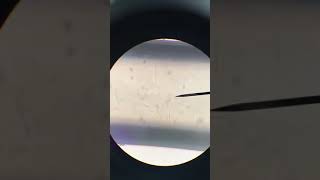 Heartworm under microscope Dirofilaria immitis Veterinary Video [upl. by Atirys68]