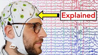 EEG Electroencephalogram Explained [upl. by Adav]