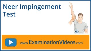 Neer Impingement Test [upl. by Yartnoed895]