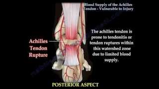 Achilles Tendon rupture  Vulnerablity to Injury  Everything You Need To Know  Dr Nabil Ebraheim [upl. by Chally]