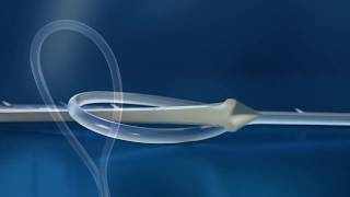 VLoc™ Wound Closure Device StepsforUse Video [upl. by Orit]