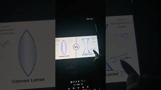 Concave vs convex lens opthalmology [upl. by Piero]