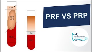 PRP Therapy 101 for Providers  What You Need to Know [upl. by Hgierb]