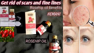 Rosehip oil for acne scars And fine lines Rosehip oil by Hemani Review [upl. by Monjan]