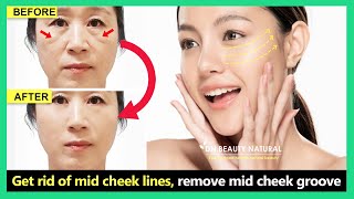 Mid Face Lift  Get rid of mid cheek lines remove midface wrinkles with Face exercise amp massage [upl. by Morril762]