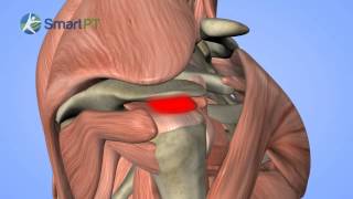 Shoulder Impingement [upl. by Kloman]