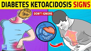 Diabetic Ketoacidosis Warning Signs You Should Know [upl. by Maressa]