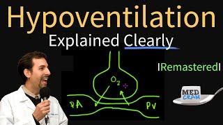 Hypoventilation and Hypoxemia Explained Clearly  Remastered [upl. by Hussar]