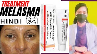 Melasma treatment HINDI Demelan cream reviewDr Malanbi [upl. by Whitby]