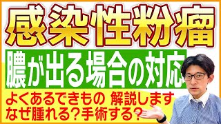 化膿して腫れ上がる感染性粉瘤について きずときずあとのクリニックでの治療法を詳しく解説します。 [upl. by Ssepmet]