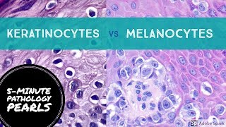 Melanocytes vs Keratinocytes Made Easy 5Minute Pathology Pearls [upl. by Kaia]