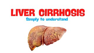 Liver Cirrhosis  Overview [upl. by Verne]