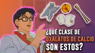 ¡CÓMO identificar CRISTALES en orina como todo un PRO 💎🔬 [upl. by Lurleen]