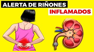 Síntomas de RIÑONES INFLAMADOS nefritis tipos causas diagnóstico tratamiento [upl. by Sitelc]