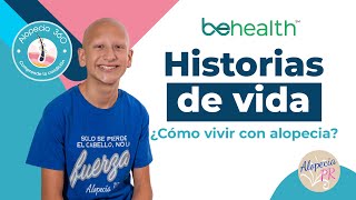 ALOPECIA y un testimonio de vida [upl. by Delano]