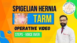 Spigelian Hernia TARM  Laparoscopic  Minimal Editing  Steps  Voice Over [upl. by Drofiar]