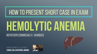 Hemolytic Anemia  Short Case [upl. by Zebe]