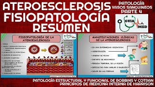 ATEROESCLEROSIS FISIOPATOLOGÍA RESÚMEN  GuiaMed [upl. by Oisorbma]