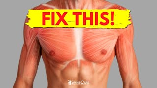 How to Fix Chest Muscle Tightness in 30 SECONDS [upl. by Annayram]