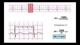 Determine HR from a RegularRhythm EKG  1500 amp 300methods [upl. by Ibmab]