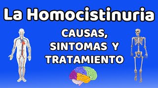 LA HOMOCISTINURIA Causas signos y síntomas diagnóstico y tratamiento [upl. by Obidiah815]