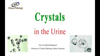 Urine analysis Part 4 Crystals in urine sediment [upl. by Funda]