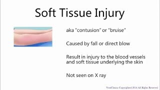 Soft tissue injury [upl. by Einnal]