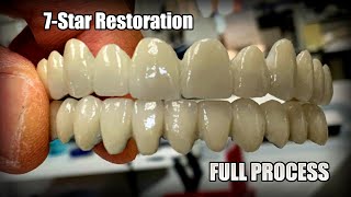 StepByStep Full Process of Making a FullMouth 7Star Restoration with Me [upl. by Royden]