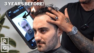 He Tried EVERY Treatment for HAIR LOSS Transplant Medication Hair System  Talking Hair Loss S2 [upl. by Lhamaj292]