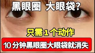 黑眼圈、大眼袋？1个动作全消除！坚持10分钟，黑眼圈、大眼袋彻底消失！【饮食养生大智慧】 [upl. by Nosloc]