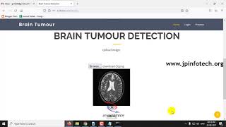 Brain Tumour Detection Using Deep Learning  Python IEEE Final Year Project [upl. by Nawrocki]