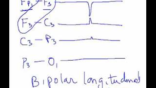 EEG  Localization [upl. by Daniele]