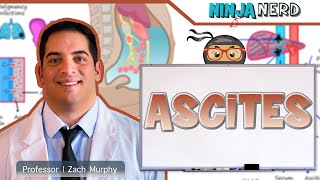 Ascites  Clinical Medicine [upl. by Soisanahta]