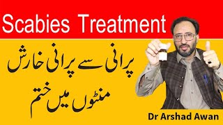 How To Treat Scabies In Urdu  Kharish Ka Fori ilaj [upl. by Dwayne723]