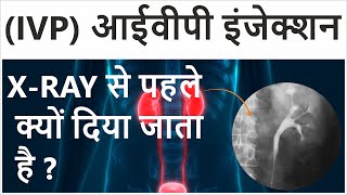 Intravenous Pyelogram in Hindi  Intravenous Pyelogram Procedure  IVP Test for Kidney [upl. by Dunseath]