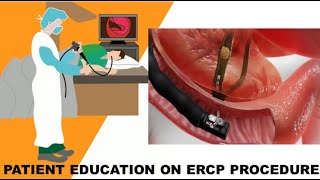 Patient Education On ERCP Procedure [upl. by Voleta]