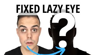 Lazy Eye Fixed amblyopia strabismus [upl. by Rennerb960]