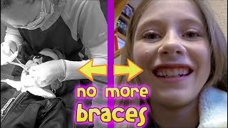 NO MORE BRACES with Elliana Walmsley [upl. by Nelra]