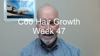 C60 Hair Growth Week 47  Final Episode In My Hair Growth Series [upl. by Schoenberg]