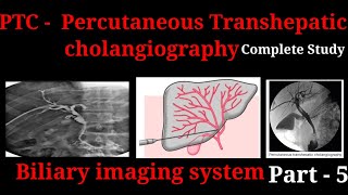 Percutaneous Transhepatic Cholangiography  PTC  Procedure  Biliary imaging system part  5 [upl. by Leorsiy]